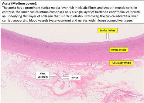 Histology Of Blood Vessels - vrogue.co