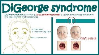 Velocardiofacial Syndrome