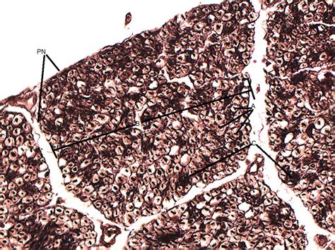 Peripheral Nerve Histology Cross Section