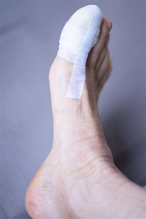 Foot Big Toe Bandage Injury Stock Image - Image of medicine, broken: 240394433