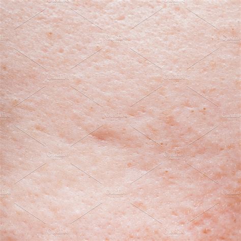 Human face skin texture featuring abstract, acne, and background | People Images ~ Creative Market