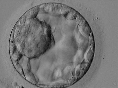 B. Inner cell mass morphology - Eshre