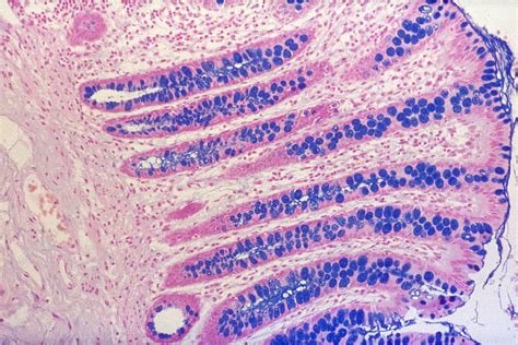 Large Intestine, Goblet Cells, LM - Stock Image - C050/5192 - Science Photo Library