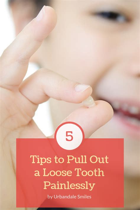 Pin on #DentalHealth