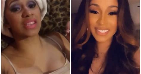 Cardi B's Teeth Transformation — A Complete Breakdown