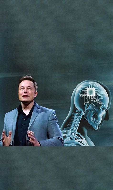 9 revealing facts about Elon Musk’s Neuralink