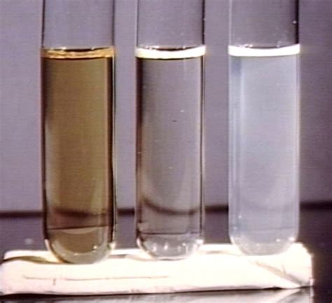 Cerebral Spinal Fluid (CSF) - Urinalysis and Body Fluids