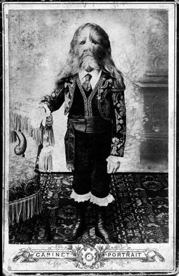 Lionel the Lion Faced Boy (Stephan Bibrowski) | freaks and old photos ...