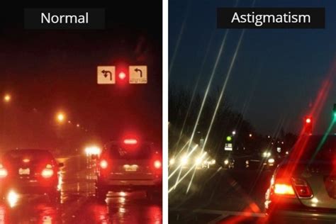 A Complete Guide to Astigmatism: Symptoms, Causes.