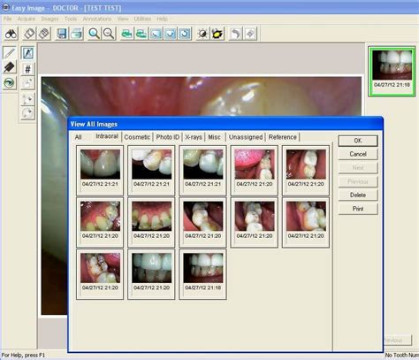 Intraoral Camera Step by Step Easy Dental Intraoral Camera Integration ...