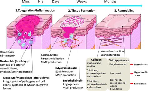 Stage Of Wound Healing Phases | My XXX Hot Girl