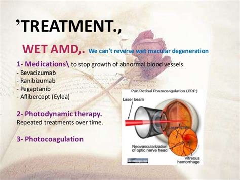 Age-Related Macular Degeneration