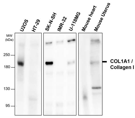 COL1A1 / Collagen I antibody (IR292-962) | iReal Biotechnology, Inc.