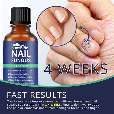 Nail Fungus Treatment for Toenail, Toenail Fungus Treatment, Toe Nail Fungus Treatment Extra ...