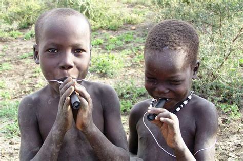 Guinea Worm Disease: Download High-resolution Photos