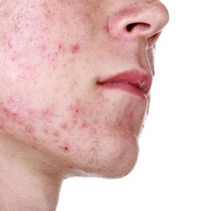 10 of the Most Common Skin Conditions: Photos and Treatments