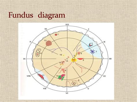 Fundus examination | PPT