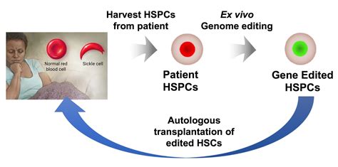 New genetic weapons challenge sickle cell disease