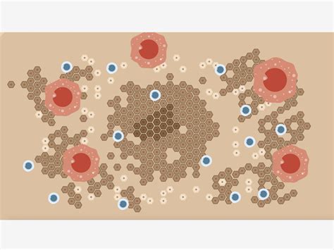 How Melanoma Deceives The Immune System, Increasing Resistance To Immunotherapy | Faculty of ...