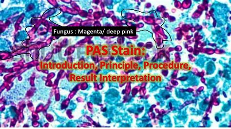 PAS Stain: Introduction, Principle, Procedure, Result Interpretation