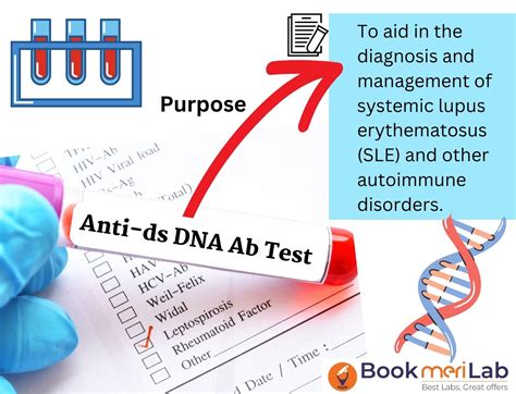 Anti dsDNA Test: Get Price, Purpose, Results & Sample Report [2024]