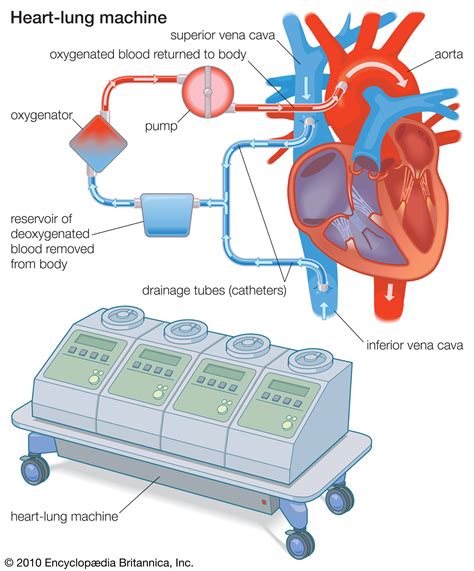 ( Heart-Lung Machine)جهاز القلب و الرئتين