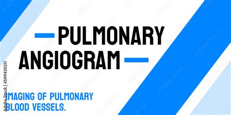 Pulmonary Angiogram: Medical test to examine blood vessels in the lungs. Stock Vector | Adobe Stock