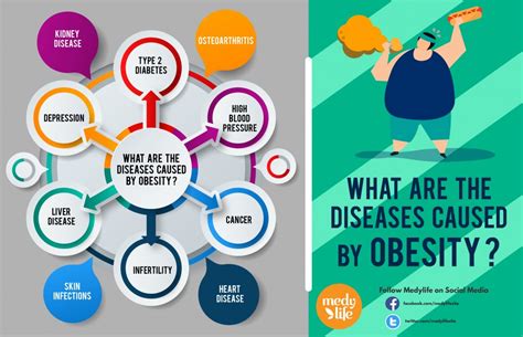 Obesity: Why it Happens and the Best ways to Overcome it! - Medy Life