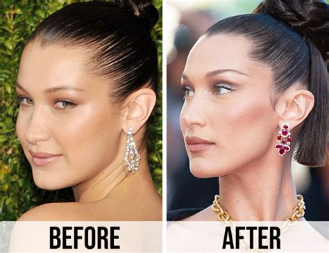 Bella Hadid Then & Now: See How Much Her Face Has Changed Over The ...