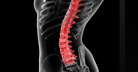 Lumbar Sympathetic Blocks and Neurolysis - PracticeMarketingRx