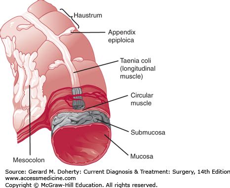 Conversion Of Taeniae Coli