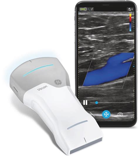 Wireless point-of-care ultrasound: First experiences with a new generation handheld device - IOS ...