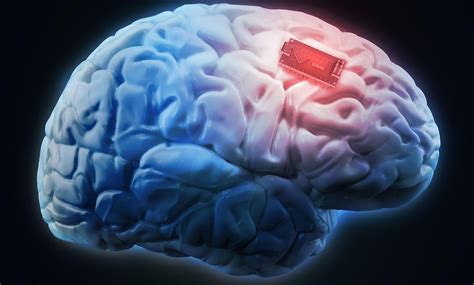 Q&A: The Ethics of Using Brain Implants to Upgrade Yourself | Human ...