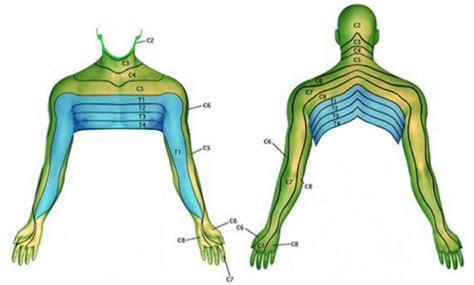 C5 6 Dermatome Map | Dermatome Map