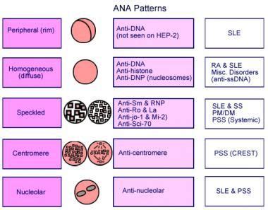 The frequency of positivity on ANA screening test (on Hep-2 cells) is as follows: Mixed ...