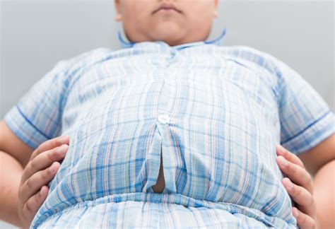 Experts willen snellere behandeling van kinderen met obesitas - Medisquare