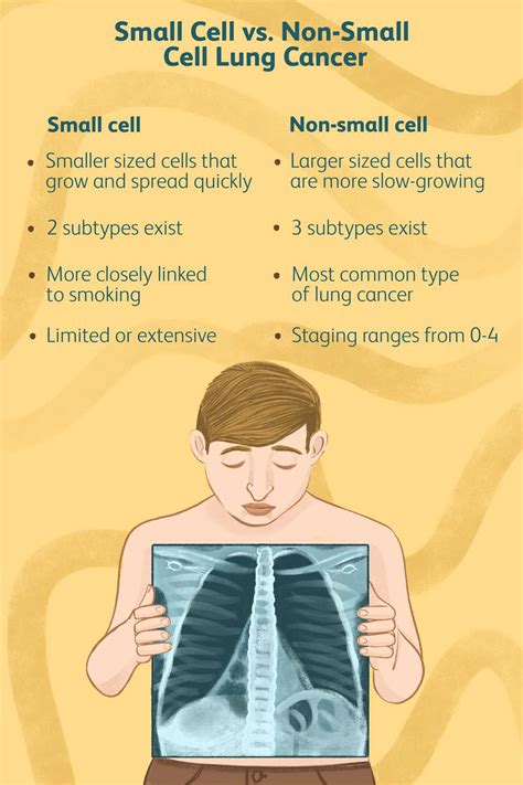 Small Cell vs. Non-Small Cell Lung Cancer