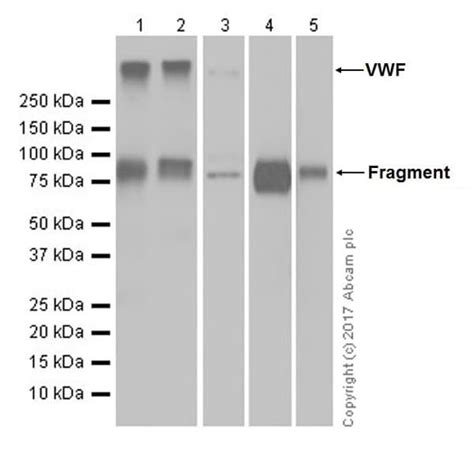 Recombinant Anti-Von Willebrand Factor antibody [EPR18569-105] (ab189500)