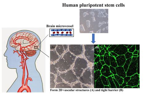 UW scientists create a recipe to make human blood-brain barrier