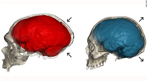 Neanderthal Skull Diagram