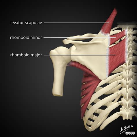 Image | Radiopaedia.org