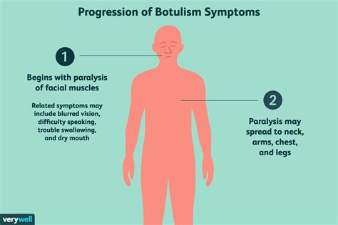 Wound Botulism