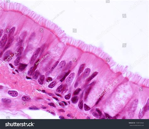 539 Trachea Microscope Bilder, Stockfotos und Vektorgrafiken | Shutterstock