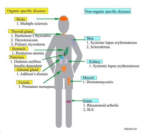 Is Pots An Autoimmune Disease at Louis Blackman blog