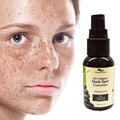 Organic Dark Spot Corrector for Age Spots & Hyperpigmentation | Skin ...