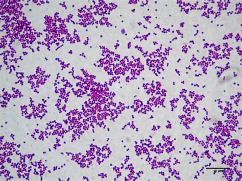 Staphylococcus aureus