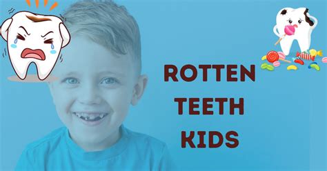 Rotten Teeth Kids: Everything About Tooth Decay in Kids