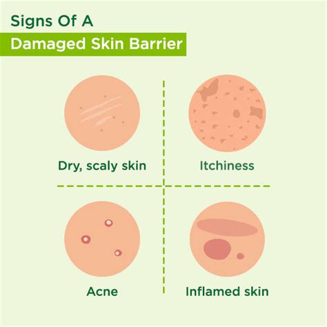 Skin Barrier: What Is It & How to Keep It Strong | Simple Skincare