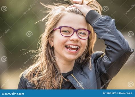 Portrait of a Happy Smiling Teenage Girl with Dental Braces and Glasses ...