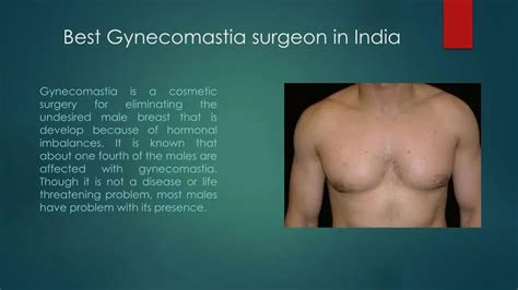 PPT - Best gynecomastia surgery in Delhi PowerPoint Presentation, free ...